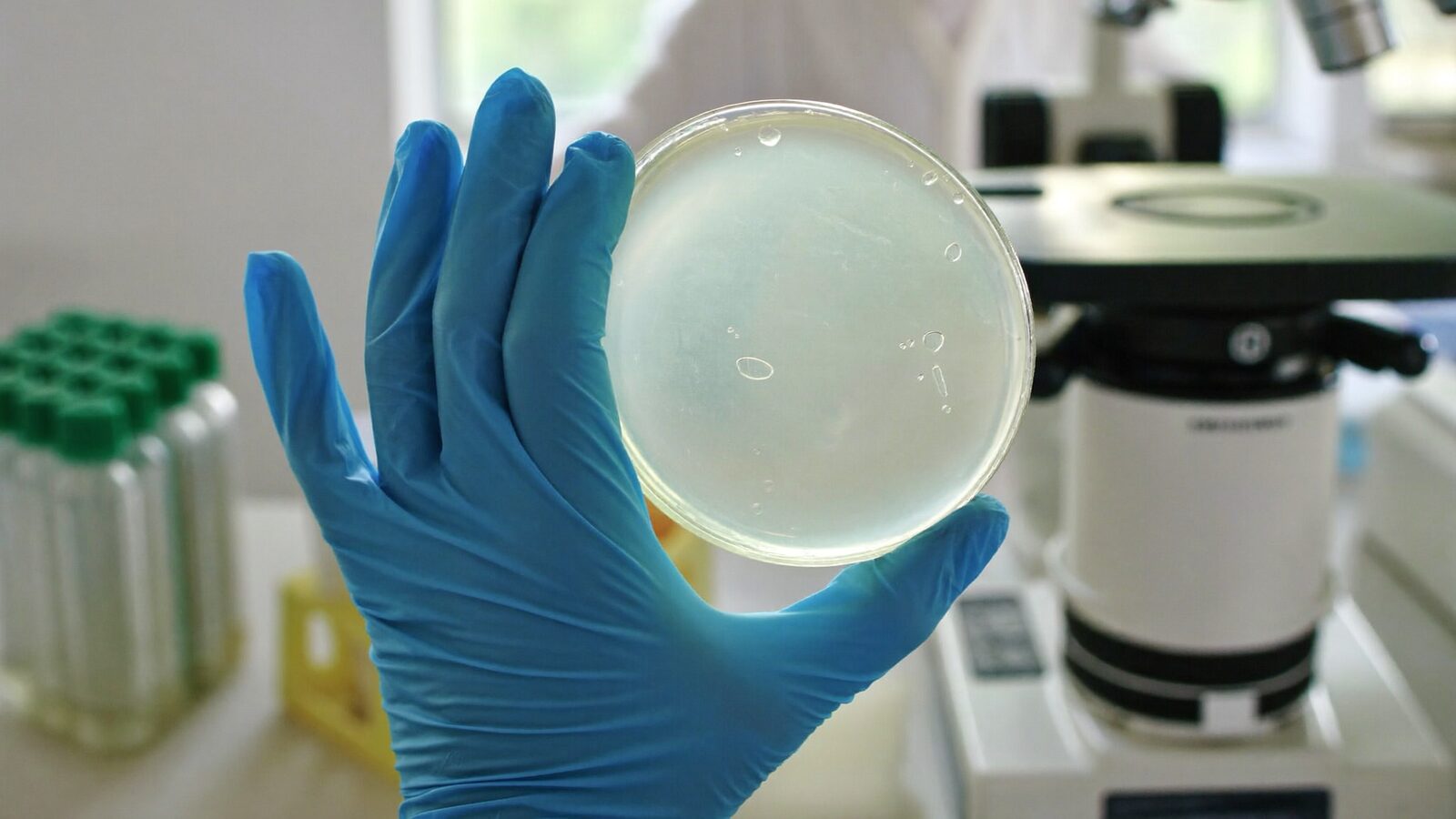 Gloved hand holding a petri dish in a bright research laboratory