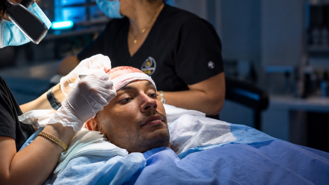 DHI hair transplant procedure in progress at Nova Medical Boston, technician placing grafts along the hairline